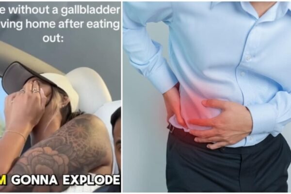 Are you experiencing unexpected diarrhea after gallbladder surgery? The doctor explains why