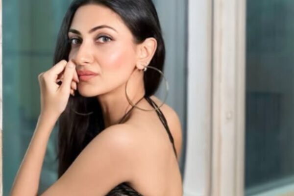 How safe to use turmeric on the skin: daughter -in -law of a friend Chopra Nilea opens the skin’s reaction, which she had during the Haldi ceremony | – India’s times