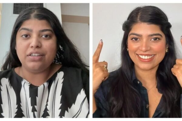 A woman who lost 40 kg shows how her face has changed dramatically after weight loss in incredible before and after video