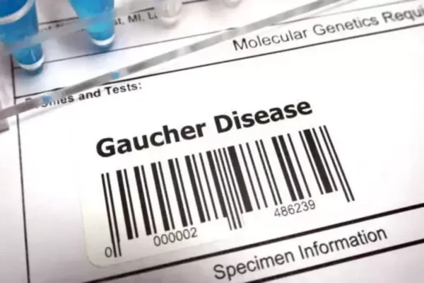 Gosh’s disease: What is it? The doctor explains the types, symptoms, treatment