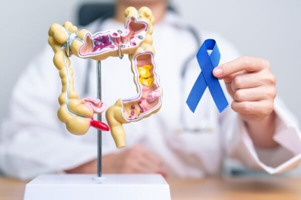 Exposure to childhood bacterial toxin can cause rectal cancer: study