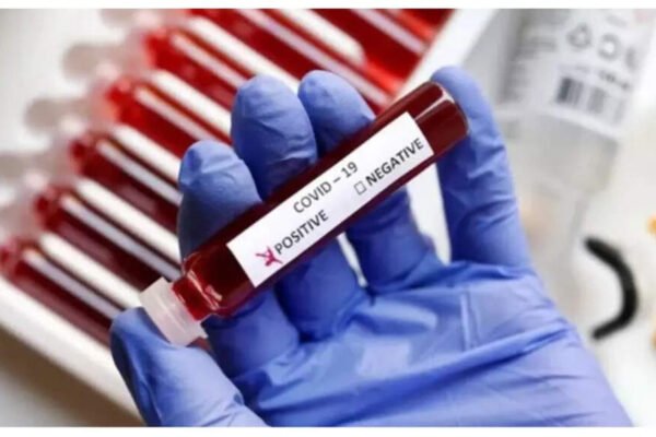 Symptoms of Coronavirus: India sees overload in 19 cases with new variants of NB.1.8.1 and LF.7; Here’s how to keep anxiety in fear – India’s times