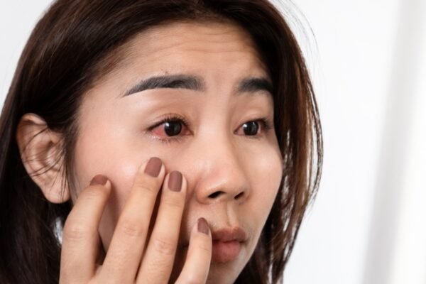 Doctor explains 7 hormonal fluctuations can affect your eyes: glaucoma to dry eyes