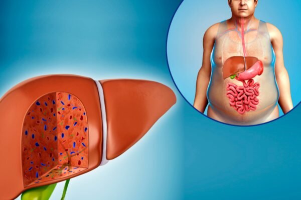 Fatty liver: 5 drinks that can cure fatty liver | – India’s times