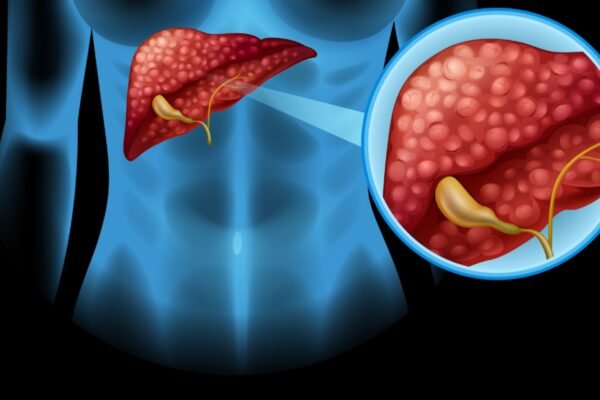 3 common products that secretly cause liver – India’s time