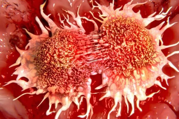 Changing games in cancer study? South Korean scientists overheat tumor cells without chemotherapy and rays | – India’s times
