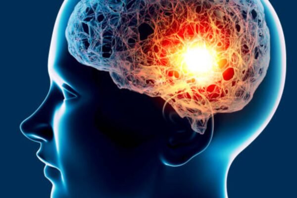 Brain aneurysms – it’s silent murderers – that’s why – India’s time