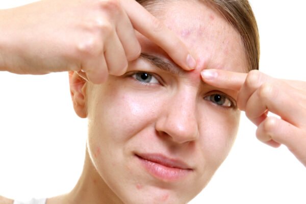 Want to jump out the pimmer before the big day? Dermat shares how to do it safely, step -by -step