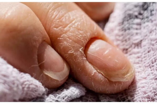 10 hidden warnings that give our nails about body health – India’s time