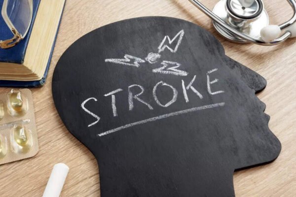 Stroke: People with this blood are faced with a higher risk of early stroke | – India’s times