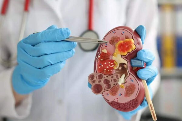 10 everyday habits that can cause kidney damage without knowing | – India’s times