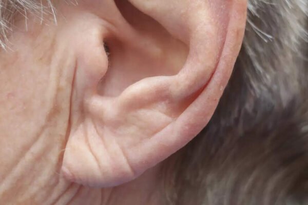 Symptoms of a heart attack: the lobe at the mouth sign of a heart attack or stroke? The expert weighs in | – India’s times