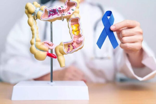 Colon cancer against irritated bowel syndrome: How to recognize symptom differences – India’s times