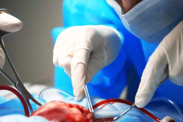 Aggram Agggioplasty: key differences, procedures and what to expect | – India’s times